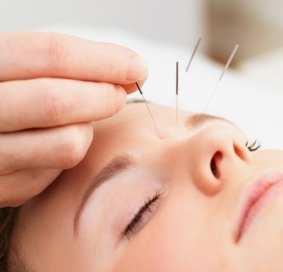 acupuntura medicina china